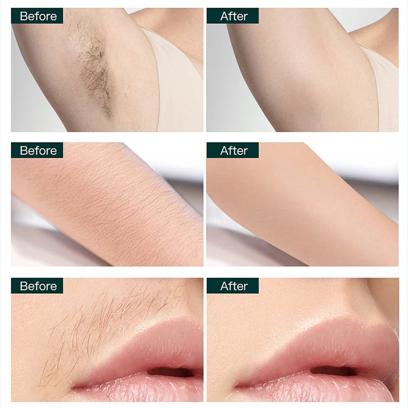 Women Electric Epilator Body Facial Hair Removal Defeatherer Cotton Thread Depilator Beauty Hair Removal Personal Care Appliance